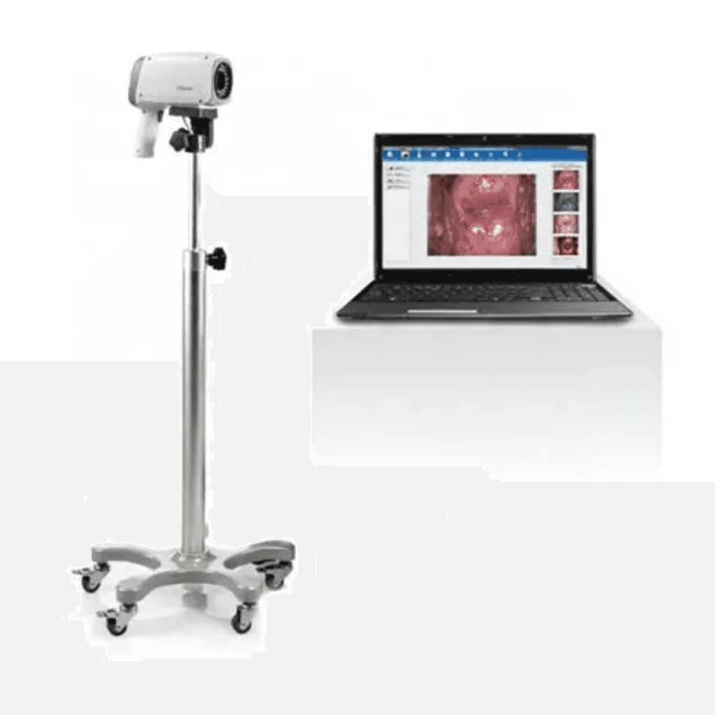 Image de C6A HD VIDEO COLPOSCOPE EDAN - EDAN